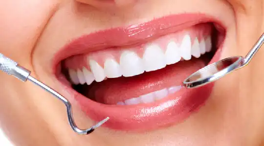 teeth whitening