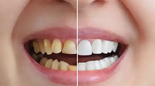 dental clinic in kanpur